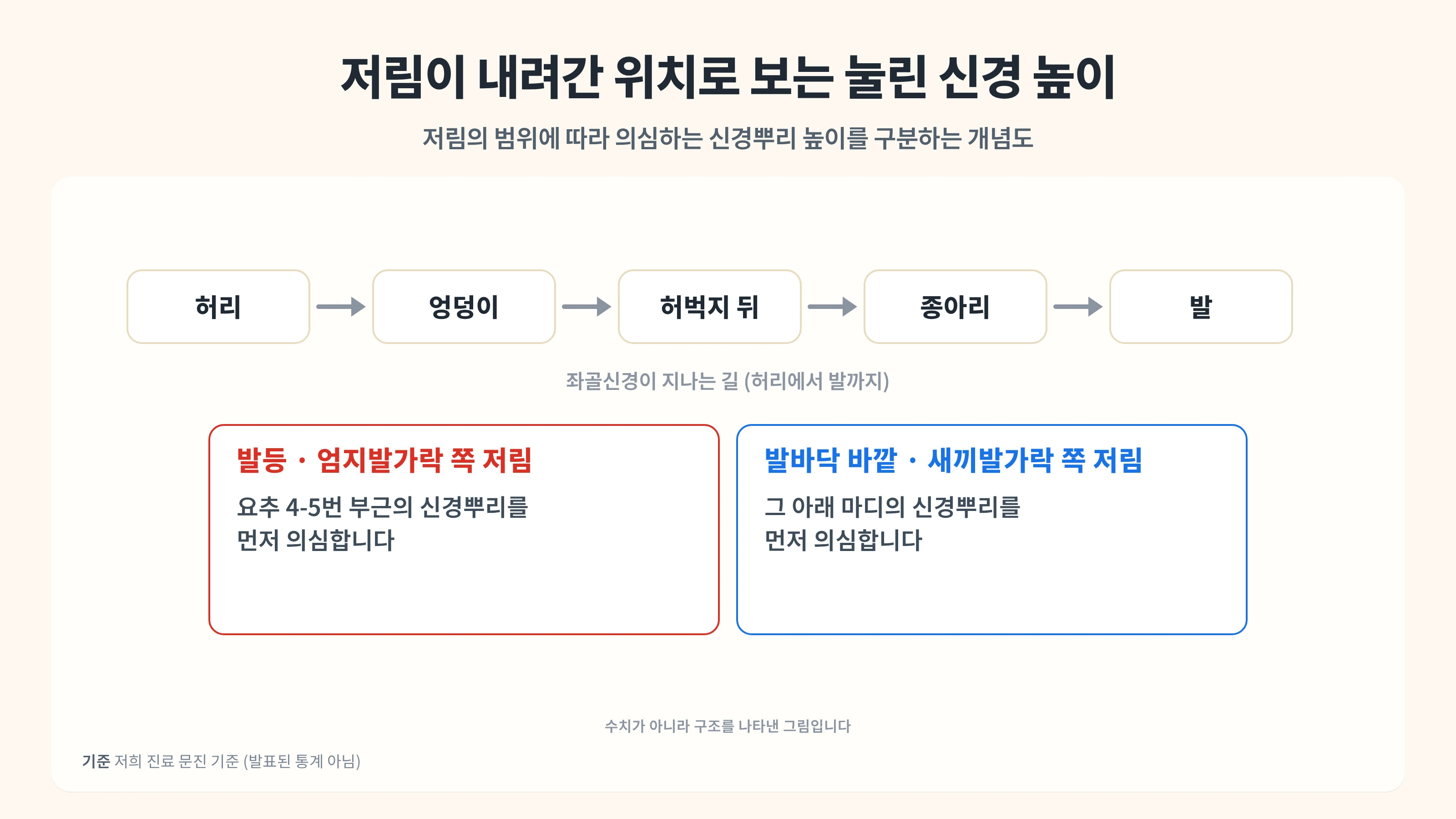 다리까지 저린 좌골신경통, 단순 요통과 다른 점 — 관악구 한의원의 침 치료